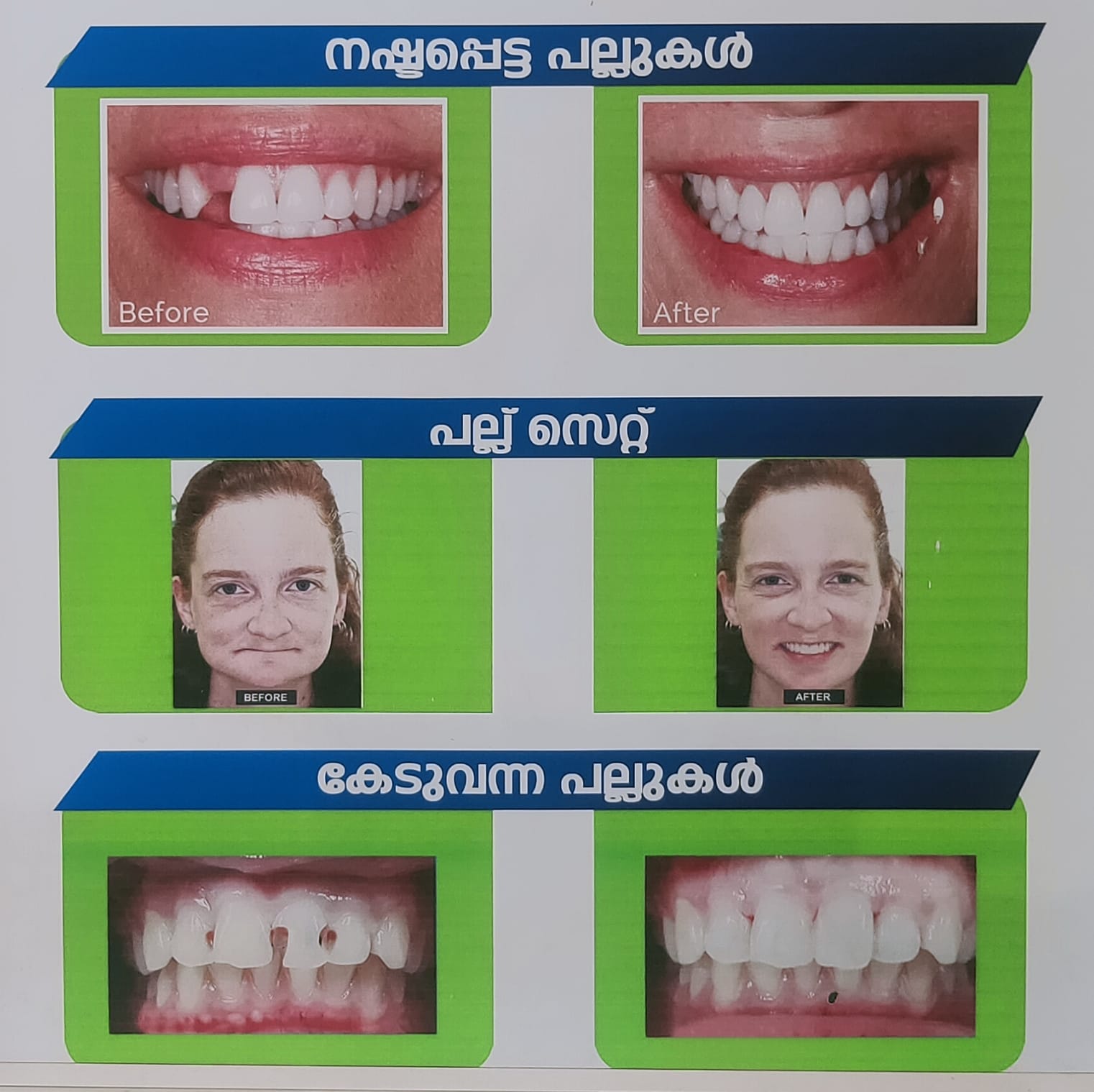 Aesthetica Speciality Dental Clinic Kuttippala